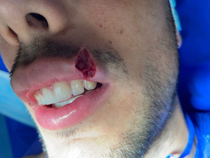 Polémica y codazo en el Burgos-Eibar