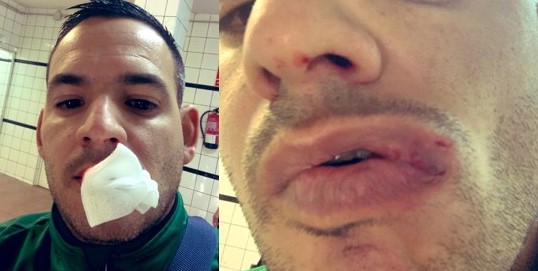 El portero Aitor Suárez, del Estrella, denuncia la agresión de un rival